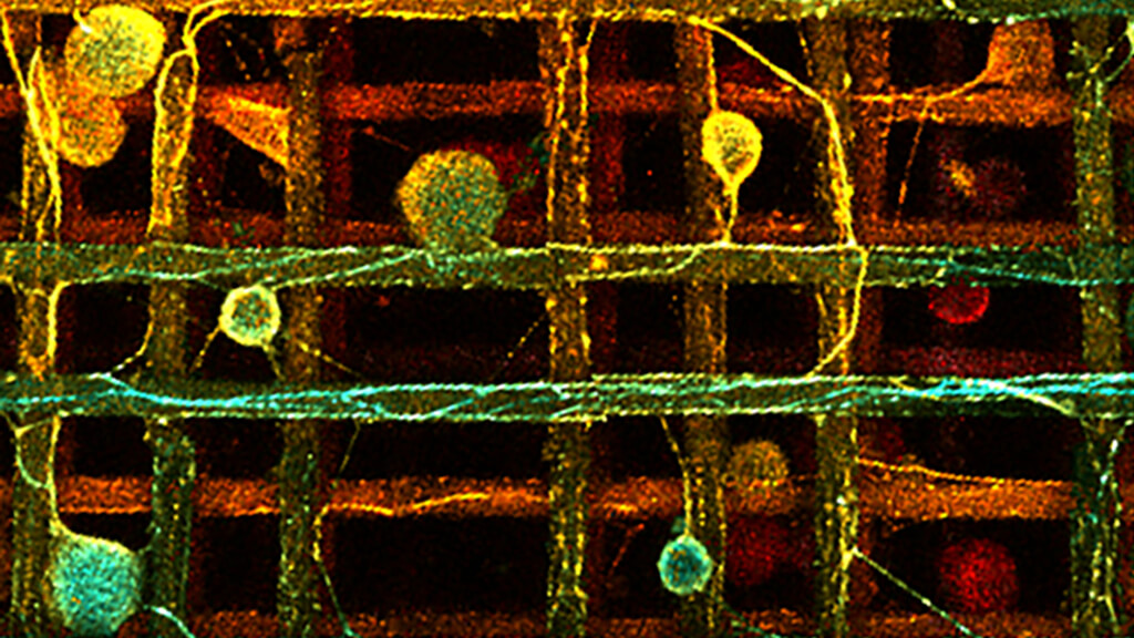 Neurons on a Scaffold