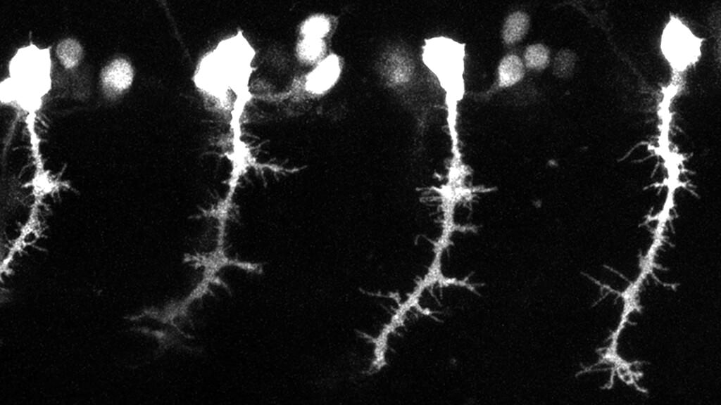 Arlotta Neuron Growth