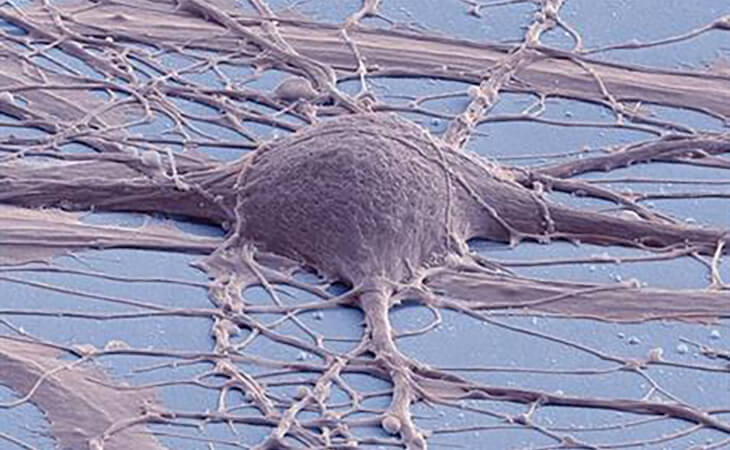 Cultured Human Neuron