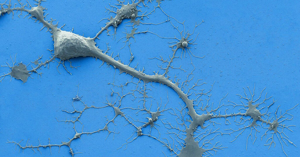 Neuron with dendrites and axons.