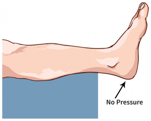 Relieve Skin Pressure from the Foot