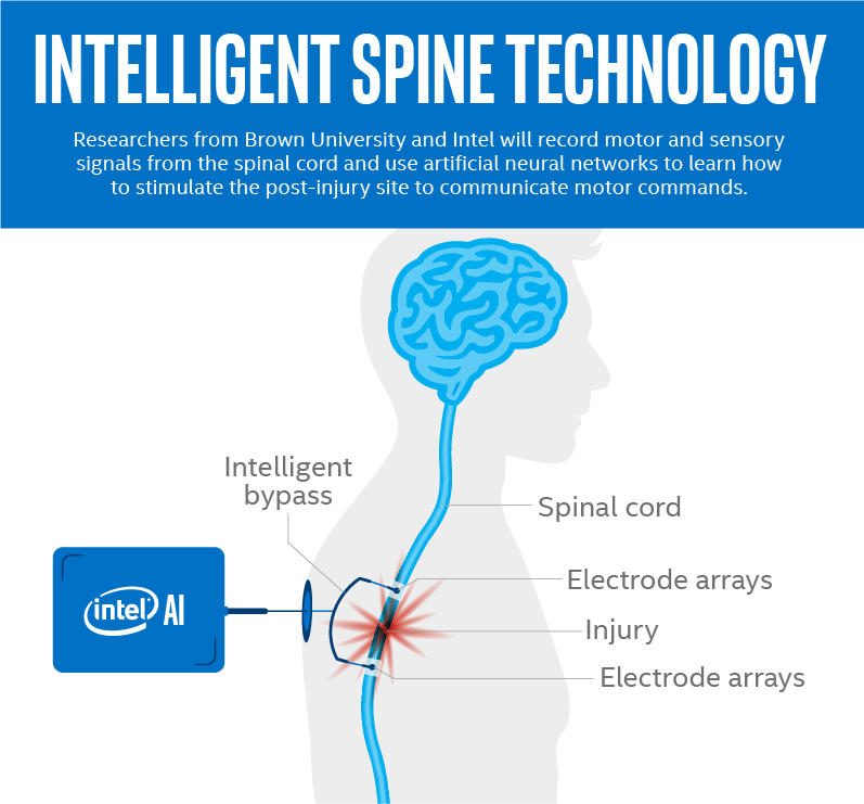 Intelligent Spine Technology