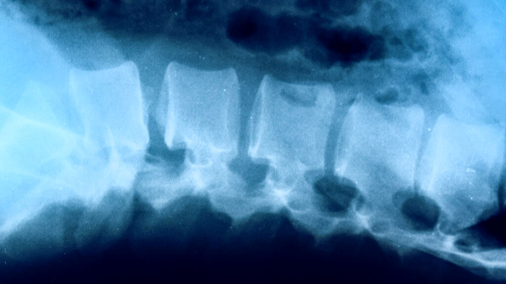 X-ray of the Spine